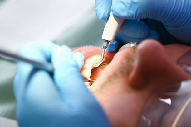 Best Emergency Care for Gum Disease in Vardaman, MS