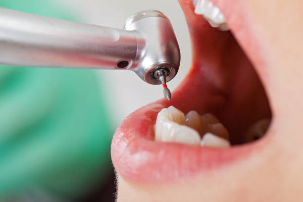 Best Dental Abscess Treatment in Vardaman, MS